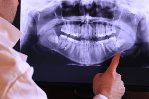 Best Urgent Dental Care for Toothaches in Woodbridge, VA